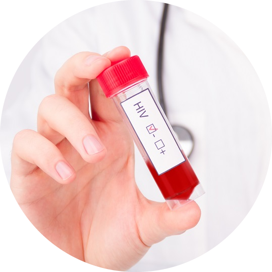 hiv